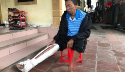 Thông tin mới vụ người cha già bị con trai đánh gãy 2 xương sườn, mẻ xương ống